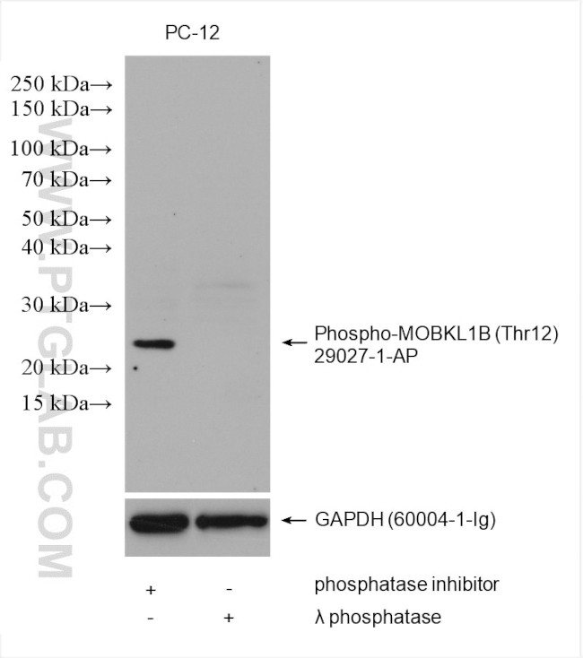 Phospho-MOBKL1B (Thr12) Antibody in Western Blot (WB)