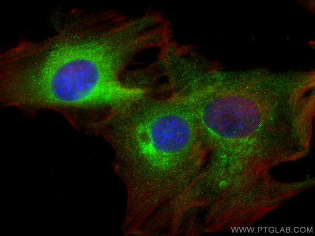 CES1 Antibody in Immunocytochemistry (ICC/IF)