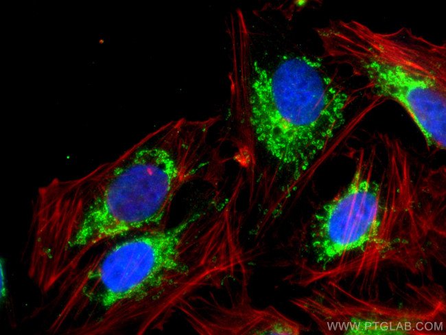 TRMT10C Antibody in Immunocytochemistry (ICC/IF)