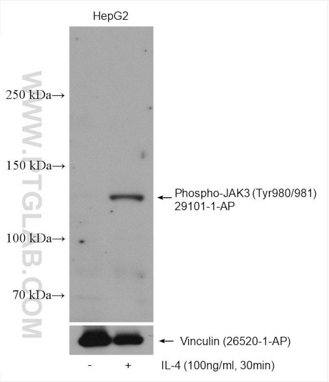 Phospho-JAK3 (Tyr980, Tyr981) Antibody in Western Blot (WB)