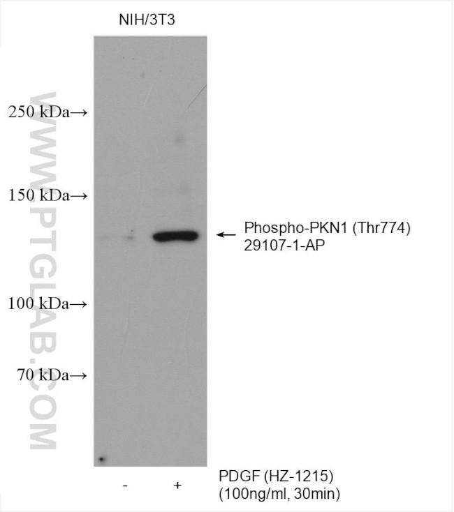 Phospho-PKN1 (Thr774) Antibody in Western Blot (WB)