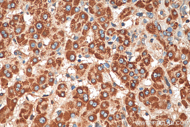 RAB20 Antibody in Immunohistochemistry (Paraffin) (IHC (P))
