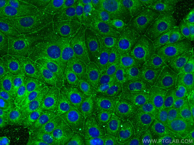 RABIF Antibody in Immunocytochemistry (ICC/IF)