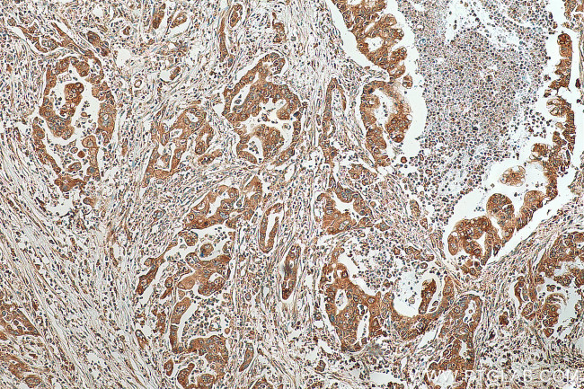 PTH1R Antibody in Immunohistochemistry (Paraffin) (IHC (P))