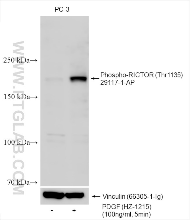 Phospho-RICTOR (Thr1135) Antibody in Western Blot (WB)