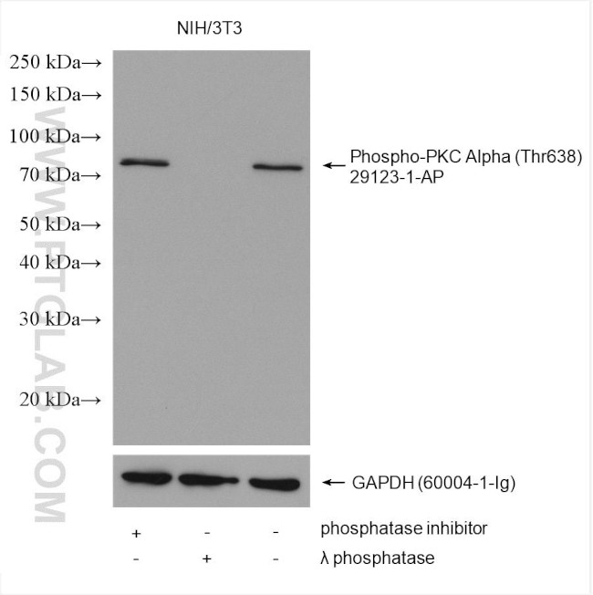 Phospho-PKC Alpha (Thr638) Antibody in Western Blot (WB)
