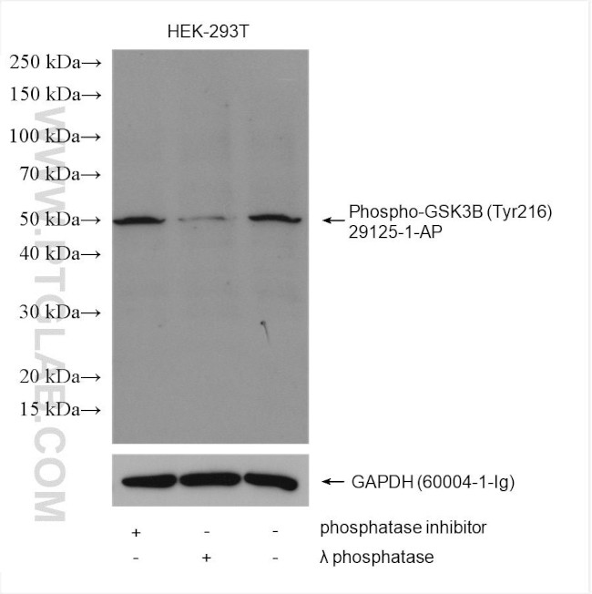 Phospho-GSK3B (Tyr216) Antibody in Western Blot (WB)