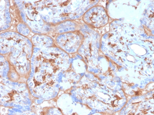PD-L1/PDCD1LG1/CD274/B7-H1 (Cancer Immunotherapy Target) Antibody in Immunohistochemistry (Paraffin) (IHC (P))