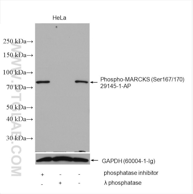 Phospho-MARCKS (Ser167, Ser170) Antibody in Western Blot (WB)