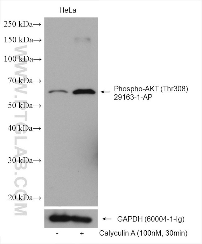 Phospho-AKT (Thr308) Antibody in Western Blot (WB)