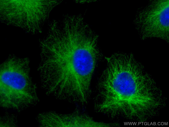 PLEC Antibody in Immunocytochemistry (ICC/IF)