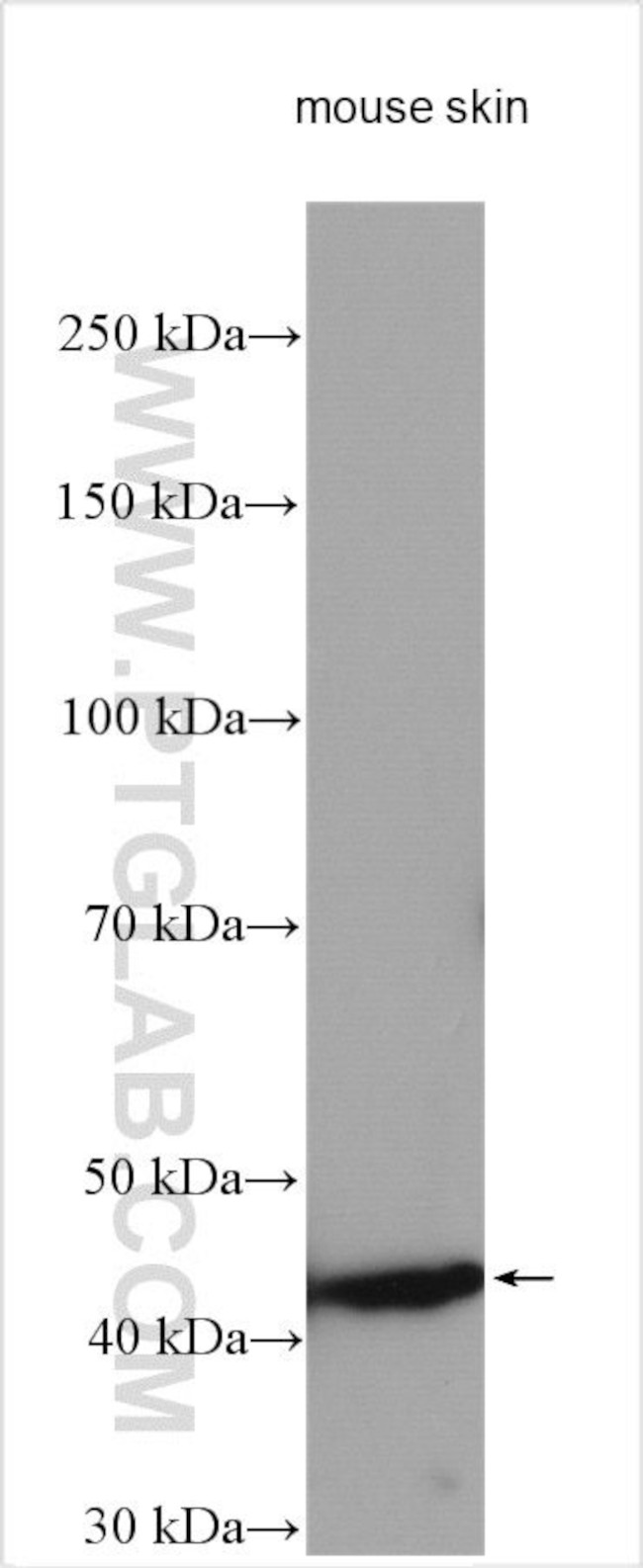 SULT2B1 Antibody in Western Blot (WB)