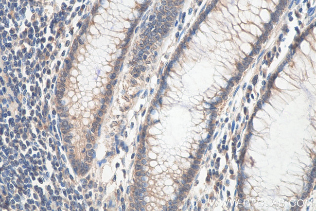 SEMA4B Antibody in Immunohistochemistry (Paraffin) (IHC (P))