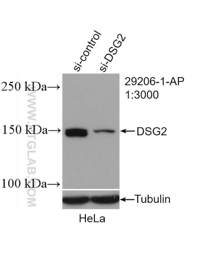 DSG2 Antibody in Western Blot (WB)