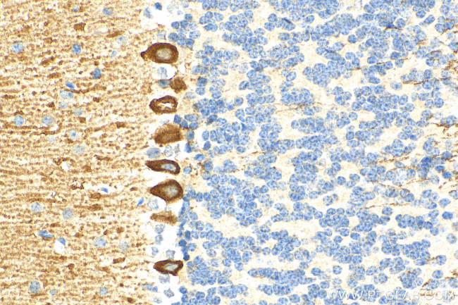 PKC Gamma Antibody in Immunohistochemistry (Paraffin) (IHC (P))