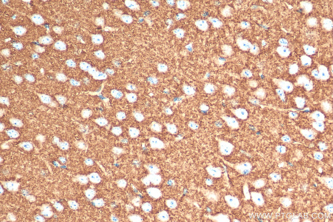VGLUT2 Antibody in Immunohistochemistry (Paraffin) (IHC (P))