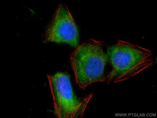 TYW3 Antibody in Immunocytochemistry (ICC/IF)