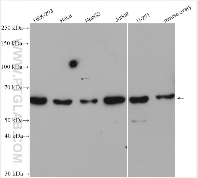 CDK17 Antibody in Western Blot (WB)