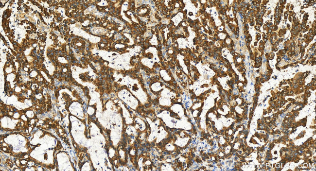 ALG9 Antibody in Immunohistochemistry (Paraffin) (IHC (P))