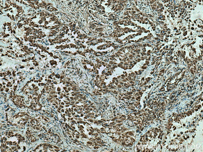 CBLL1 Antibody in Immunohistochemistry (Paraffin) (IHC (P))