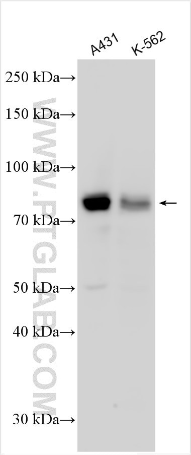 RPS6KA1 Antibody in Western Blot (WB)