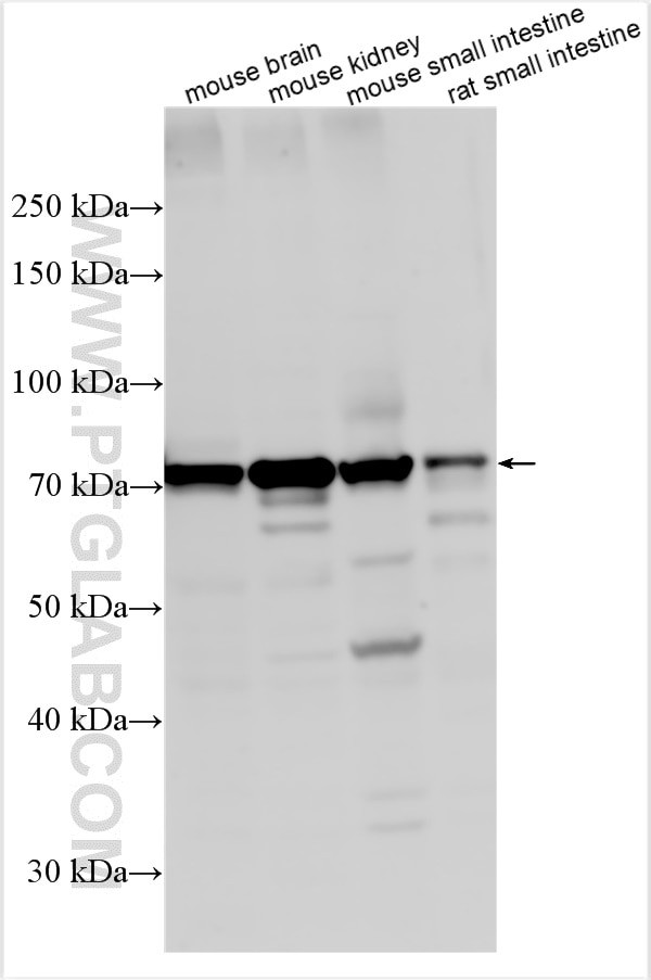CLCN7 Antibody in Western Blot (WB)
