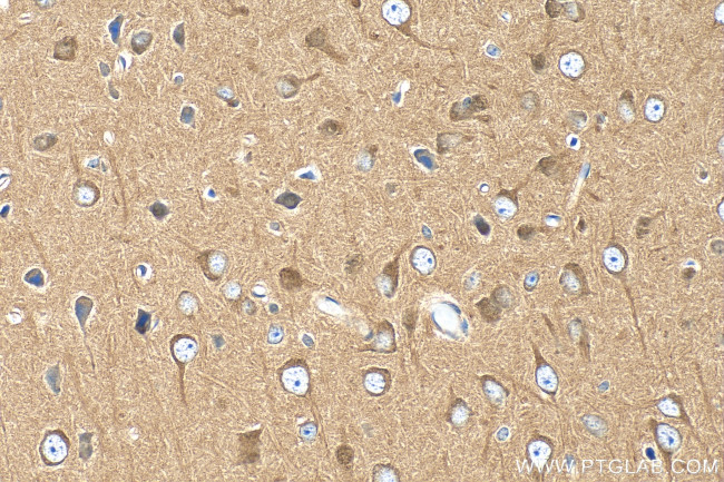 PPP2R2B/A/C/D Antibody in Immunohistochemistry (Paraffin) (IHC (P))