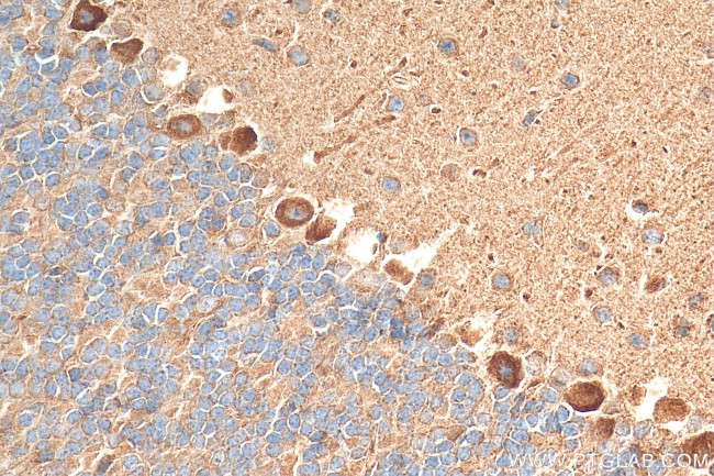 HTR7 Antibody in Immunohistochemistry (Paraffin) (IHC (P))