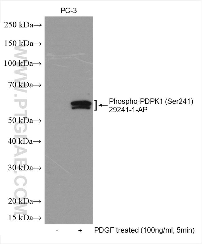Phospho-PDPK1 (Ser241) Antibody in Western Blot (WB)