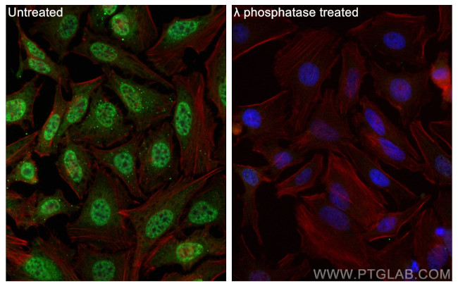 Phospho-p70 (S6K) (Thr421, Ser424) Antibody in Immunocytochemistry (ICC/IF)