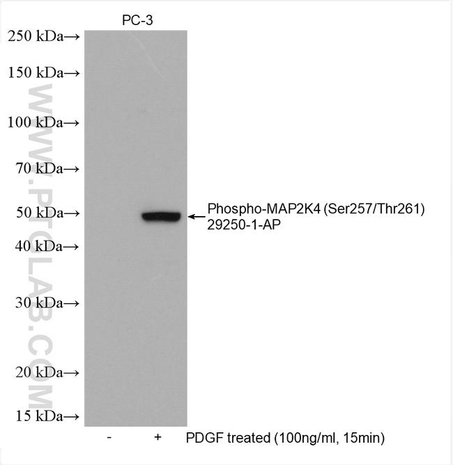 Phospho-MAP2K4 (Ser257, Thr261) Antibody in Western Blot (WB)