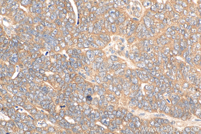 HDAC4 Antibody in Immunohistochemistry (Paraffin) (IHC (P))