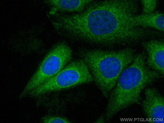 KLHL14 Antibody in Immunocytochemistry (ICC/IF)