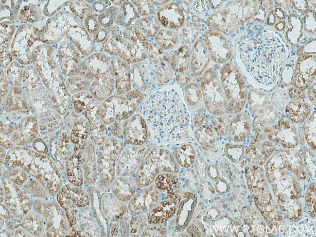 HEXA Antibody in Immunohistochemistry (Paraffin) (IHC (P))