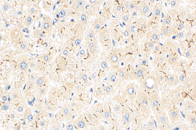 MRP2 Antibody in Immunohistochemistry (Paraffin) (IHC (P))