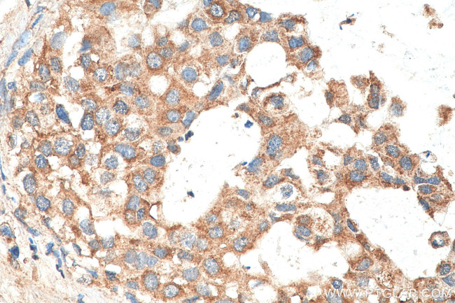 MAP3K2 Antibody in Immunohistochemistry (Paraffin) (IHC (P))