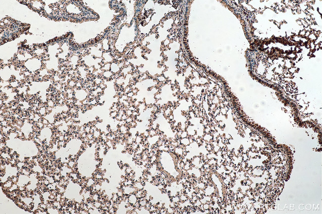 TMEM41B Antibody in Immunohistochemistry (Paraffin) (IHC (P))
