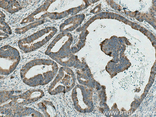 GAB2 Antibody in Immunohistochemistry (Paraffin) (IHC (P))