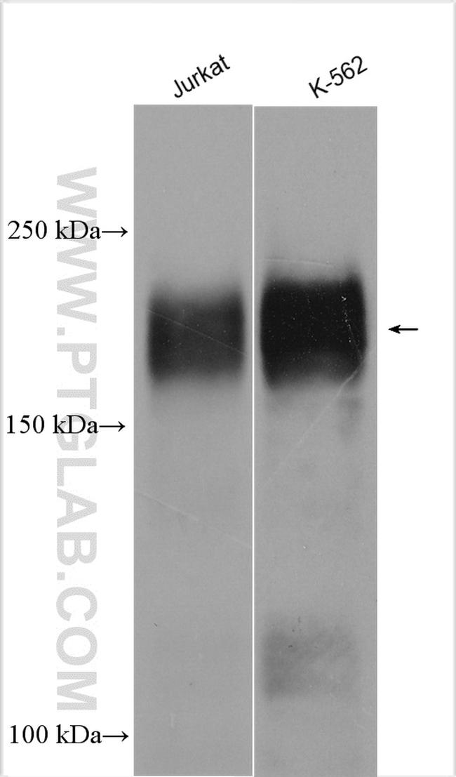 MLL Antibody in Western Blot (WB)