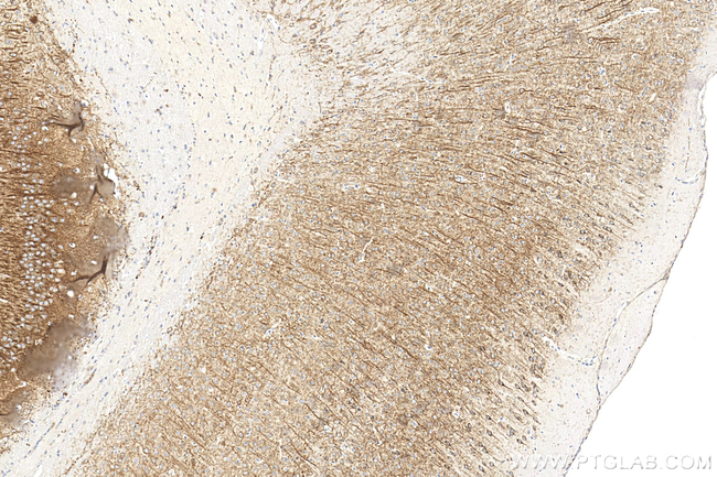 TPH2 Antibody in Immunohistochemistry (Paraffin) (IHC (P))