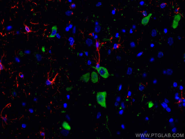 Nestin Antibody in Immunohistochemistry (Paraffin) (IHC (P))