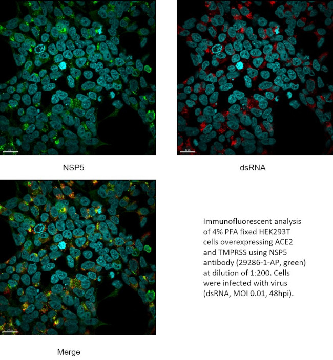 SARS-COV-2 NSP5 Antibody in Immunocytochemistry (ICC/IF)