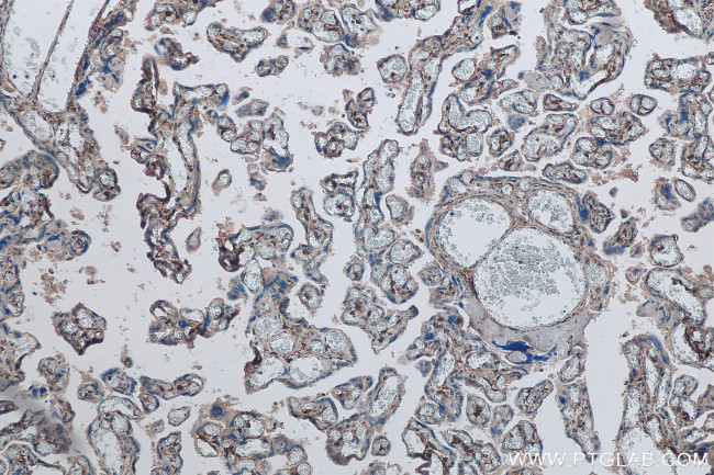DLK1 Antibody in Immunohistochemistry (Paraffin) (IHC (P))