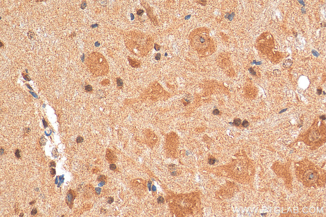 BRWD1 Antibody in Immunohistochemistry (Paraffin) (IHC (P))