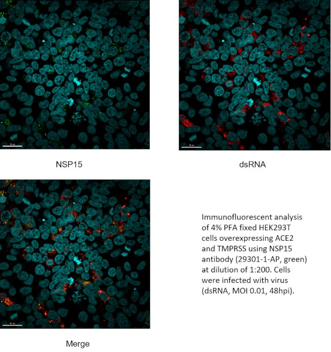 SARS-COV-2 NSP15 Antibody in Immunocytochemistry (ICC/IF)