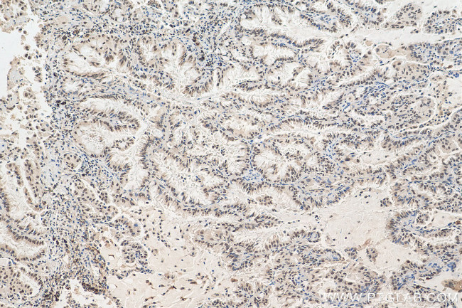 EHMT2 Antibody in Immunohistochemistry (Paraffin) (IHC (P))