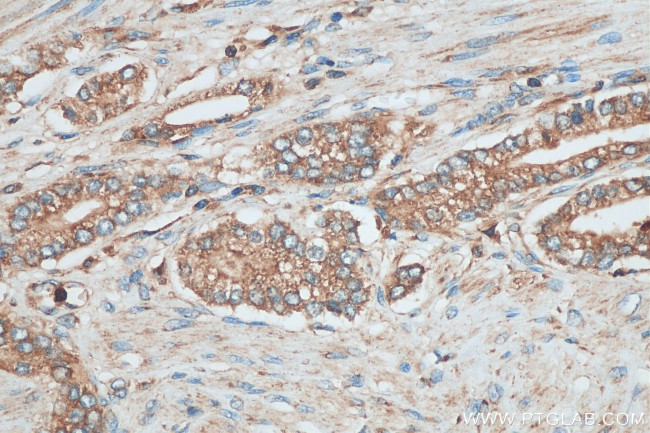 PAFAH Antibody in Immunohistochemistry (Paraffin) (IHC (P))