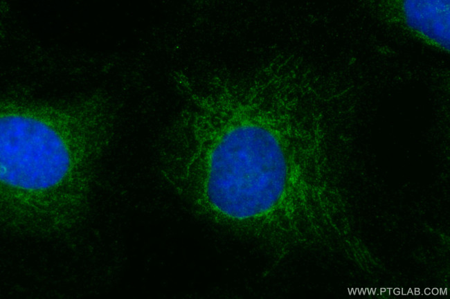 GDF9 Antibody in Immunocytochemistry (ICC/IF)