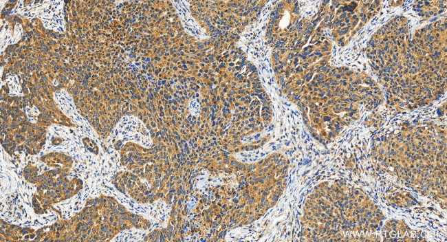 TRPC4AP Antibody in Immunohistochemistry (Paraffin) (IHC (P))