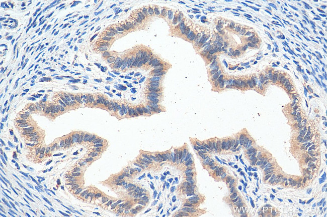 FOXP4 Antibody in Immunohistochemistry (Paraffin) (IHC (P))